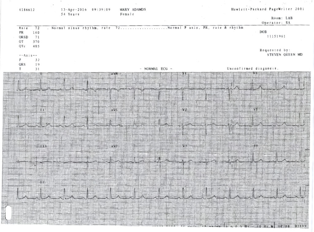 My EKG: Or, the Rosetta Stone