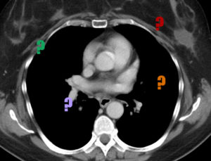 cross_section1._annotated